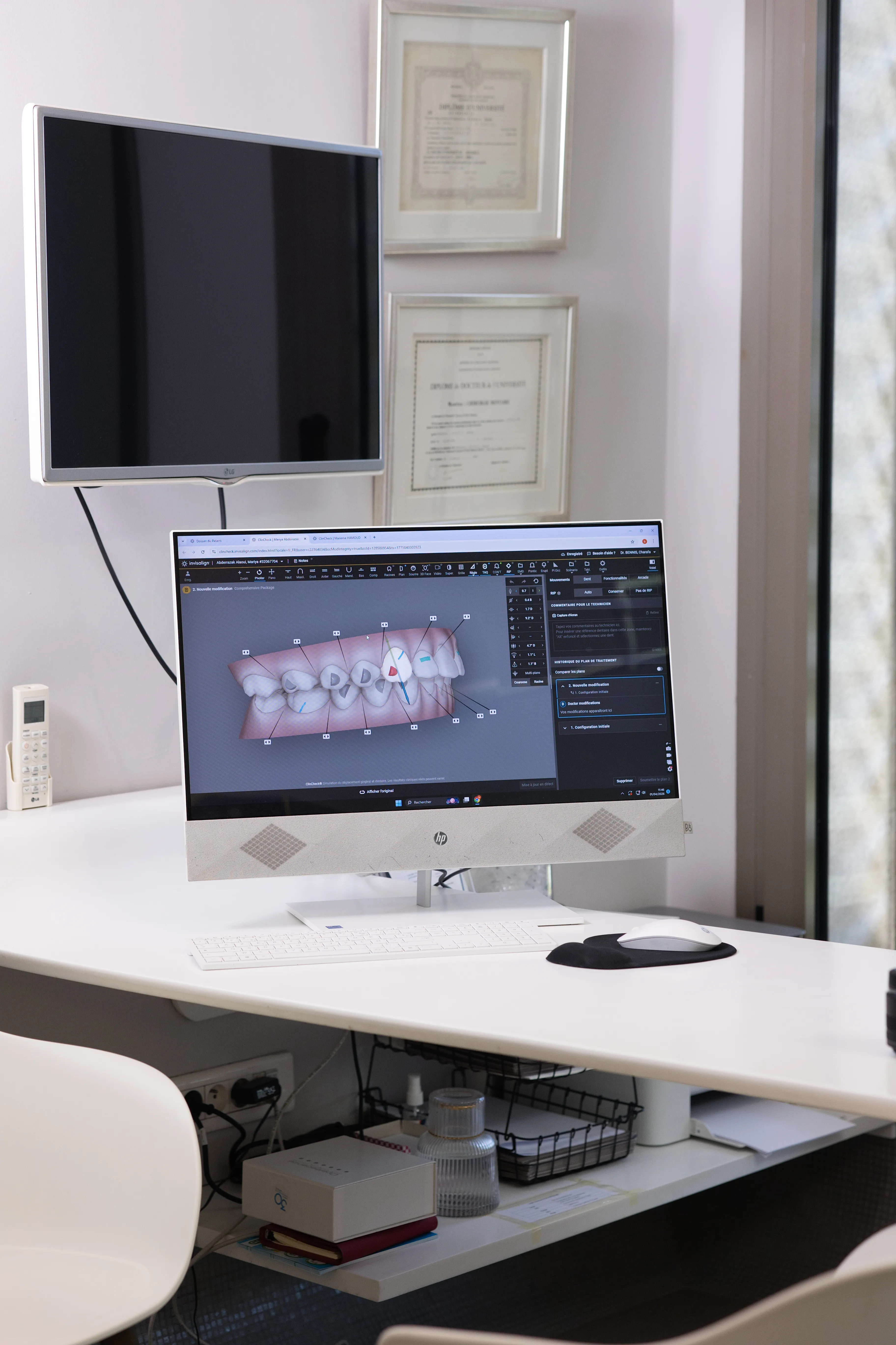 Smile View : simulation IA en 60s